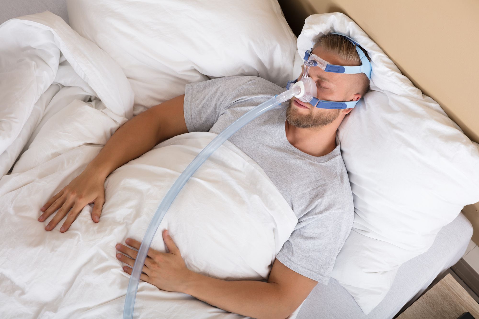 You are currently viewing How to Prevent Skin Irritation Caused by CPAP Masks