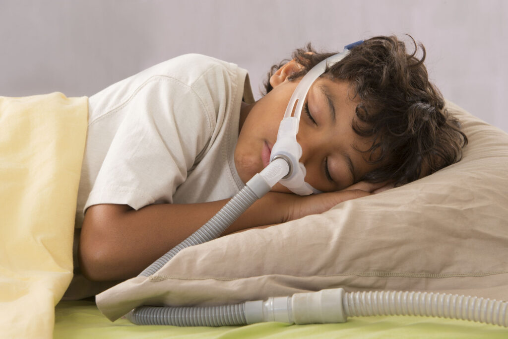 How to Prevent Skin Irritation Caused by CPAP Masks